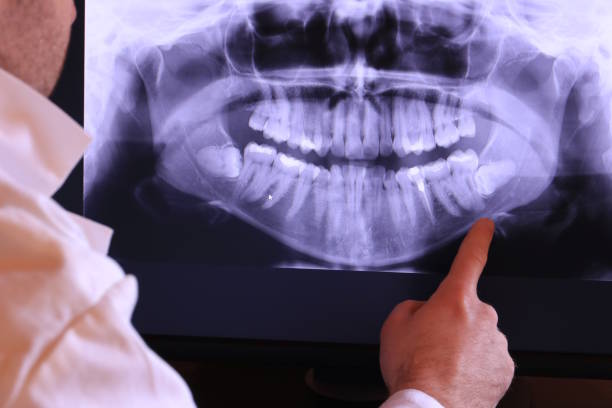 Best Emergency Dental Surgery in Mathis, TX